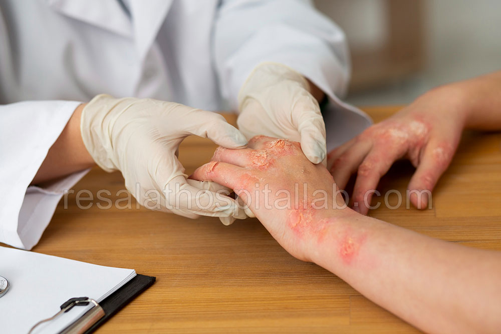 آزمایش آلرژی | انواع تست های آلرژی در آزمایشگاه بیمارستان رسالت