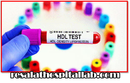آزمایش HDL | آزمایش خون HDL | تفسیر آزمایش خون HDL