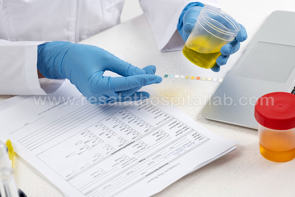 آزمایش کشت ادرار | حساسیت آنتی بیوتیک